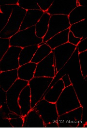 Immunohistochemical analysis of murine skeletal muscle tissue, staining Dystrophin with ab3149.Tissue was fixed with paraformaldehyde, permeabilized with Triton X-100 and blocked with 20 µg/ml BSA for 30 minutes at 25°C. Samples were incubated with primary antibody (1/200 in diluent) for 4 hours at 25°C. An AlexaFluor®546-conjugated anti-mouse monoclonal IgG (1/400) was used as the secondary antibody. See Abreview