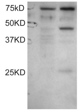 All lanes : Anti-DYX1C1 antibody (ab31287) at 0.1 µg/mlLane 1 : COS1 cell lysates untransfectedLane 2 : COS1 cell lysates transfected with full length recombinant Human DYX1C1Observed band size : 48,75 kDa (why is the actual band size different from the predicted?)Additional bands at : 24 kDa (possible non-specific binding).