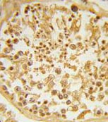 Immunohistochemical analysis of formalin-fixed, paraffin-embedded Human testis tissue labelling DZIP1 with ab135731 at 1/50 dilution, followed by peroxidase-conjugated secondary antibody and DAB staining.