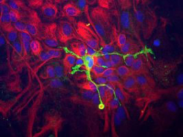 ab123574, at 1/10000, staining Coronin 1a (green) in a mixed neuron/glial culture from newborn rat brain, by immunocytochemistry. Red staining is from an anti-Vimentin antibody, while blue is a nuclear DNA counter stain.