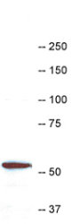 Anti-Coronin 1a antibody (ab123574) at 1/10000 dilution + HL60 Cell extract