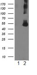 All lanes : Anti-Coronin 1a antibody [1A5] (ab119094) at 1/500 dilutionLane 1 : Lysate from HEK293T cells transfected with vector alone.Lane 2 : Lysate from HEK293T cells transfected with a vector expressing full length Coronin 1a.Lysates/proteins at 5 µg per lane.developed using the ECL technique