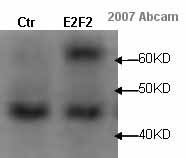 All lanes : Anti-E2F2 antibody (ab14292) at 1/3000 dilutionLane 1 : Rat cardiomyocytes whole cell lysate.Lane 2 : Rat cardiomyocytes whole cell lysate. Treated with an adenovirusLysates/proteins at 10 µg per lane.SecondaryGoat Anti-Chicken IgY H&L (HRP) (ab6877) at 1/3000 dilutionPerformed under reducing conditions.