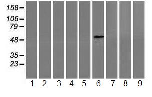 All lanes : Anti-Coronin 1a antibody [1A5] (ab119094) at 1/500 dilutionLane 1 : Extract from HepG2 cell lineLane 2 : Extract from HeLa cell lineLane 3 : Extract from SVT2 cell lineLane 4 : Extract from A549 cell lineLane 5 : Extract from COS7 cell lineLane 6 : Extract from Jurkat cell lineLane 7 : Extract from MDCK cell lineLane 8 : Extract from PC12 cell lineLane 9 : Extract from MCF7 cell lineLysates/proteins at 35 µg per lane.developed using the ECL technique