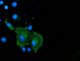 ab119094 at 1/100 dilution staining Coronin-1a in COS7 cells transiently transfected by a vector expressing Coronin-1a and analysed by Immunofluorescence.
