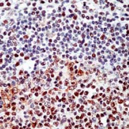 ab17845 staining E2F4 in formalin-fixed, paraffin embedded human tonsil tissue sections.