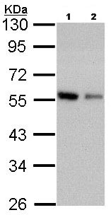 All lanes : Anti-Coronin 3 antibody (ab96266) at 1/1000 dilutionLane 1 : A431 whole cell lysateLane 2 : H1299 whole cell lysateLysates/proteins at 30 µg per lane.
