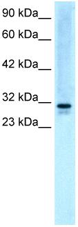 Anti-EAP30 antibody (ab22768) at 5 µg/ml + HepG2 Cell LysateSecondaryHRP conjugated anti-Rabbit IgG diluted in 1/50,000 - 100,000Performed under reducing conditions.Observed band size : 29 kDa (why is the actual band size different from the predicted?)