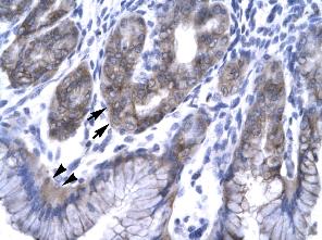 ab22768, at a 4.0-8.0 ug/ml dilution, staining human EAP30 in human stomach by immunohistochemistry, paraffin embedded tissue. Cells with positive label: epithelial cells of fundic gland (indicated with arrows) and surface mucous cells (indicated with arrow heads)