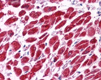 ab22768 staining EAP30 in Human heart tissue by Immunohistochemistry (Formalin/PFA-fixed paraffin embedded sections).
