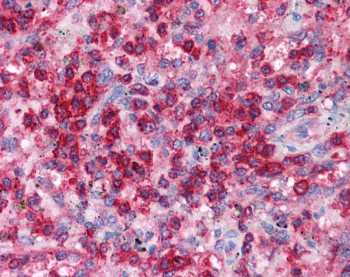 ab22768 staining EAP30 in Human spleen tissue by Immunohistochemistry (Formalin/PFA-fixed paraffin embedded sections).