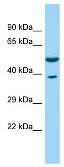 Anti-Coronin 3 antibody (ab135360) at 1 µg/ml + Human fetal brain lysate at 10 µg