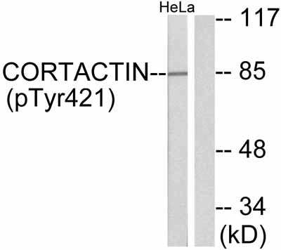 All lanes : Anti-Cortactin (phospho Y421) antibody (ab47768) at 1/500 dilutionLane 1 : Hela cell extract, treated with H2O2Lane 2 : Hela cell extract, untreated