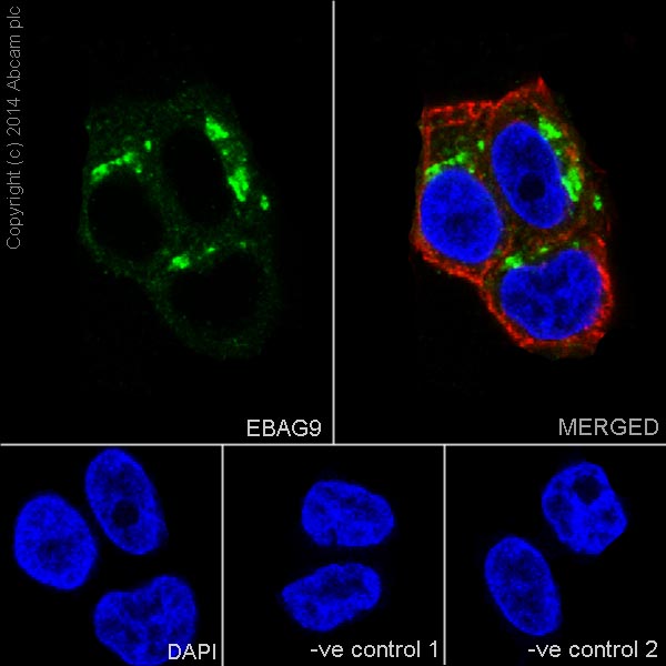 Immunofluorescent analysis of 4% paraformaldehyde-fixed, 0.1% Triton X-100 permeabilized T-47D (Human ductal breast epithelial tumor cell line) cells, labeling EBAG9 with ab200348 at 1/2000 dilution, followed by Goat anti-rabbit IgG (Alexa Fluor® 488) (ab150077) secondary antibody at 1/500 dilution (green). Cytoplasm staining on T47D cell line was observed. The nuclear counter stain is DAPI (blue). Tubulin is detected with ab7291 (anti-Tubulin mouse mAb) at 1/1000 dilution and ab150120 (AlexaFluor®594 Goat anti-Mouse secondary) at 1/500 dilution (red).The negative controls are as follows:-ve control 1: ab200348 at 1/2000 dilution followed by ab150120 (AlexaFluor®594 Goat anti-Mouse secondary) at 1/500 dilution.-ve control 2: ab7291 (anti-Tubulin mouse mAb) at 1/1000 dilution followed by ab150077 (Alexa Fluor®488 Goat Anti-Rabbit IgG H&L) at 1/500 dilution.