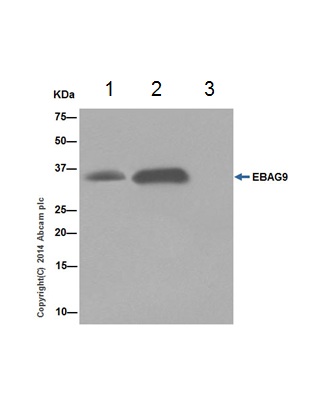 EBAG9 was immunoprecipitated from 1mg of HEK293 (Human embryonic kidney) whole cell lysate with ab200348 at 1/80 dilution. Western blot was performed from the immunoprecipitate using ab200348 at 1/1000 dilution. Anti-Rabbit IgG (HRP), specific to the non-reduced form of IgG, was used as secondary antibody at 1/1500 dilution.Lane 1: HEK293 whole cell lysate 10 µg (Input). Lane 2: ab200348 IP in HEK293 whole cell lysate. Lane 3: Rabbit monoclonal IgG (ab172730) instead of ab200348 in HEK293 whole cell lysate.Blocking and dilution buffer and concentration: 5% NFDM/TBST.