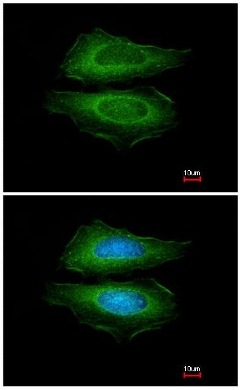 Immunofluorescence analysis of methanol fixed HeLa cells, labeling Cortactin using ab152149 at 1/200 dilution. Lower image costained with Hoerchst 33342. 