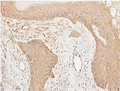 Immunohistochemical analysis of paraffin embedded xenograft tissue, labeling Cortactin using ab152149 at 1/100 dilution.