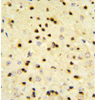 Immunohistochemical analysis of Formalin-fixed, Paraffin-embedded Mouse brain tissue labelling EBP1 with ab135525 at 1/50 dilution, followed by peroxidase-conjugated secondary antibody and DAB staining.
