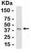 Anti-EBP1 antibody (ab37649) at 1/2000 dilution + E coli derived fusion protein SecondaryGoat anti IgY HRP at 1/1000 dilutiondeveloped using the ECL technique