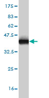 Western blot against tagged recombinant protein immunogen using ab54946 ECH1 antibody at 1ug/ml.