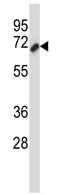Anti-Cortactin antibody (ab116554) at 1/100 dilution + HeLa cell lysate at 35 µg