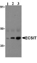 Lane 1 :  Anti-ECSIT antibody (ab21288) at 0.5 µg/mlLane 2 :  Anti-ECSIT antibody (ab21288) at 1 µg/mlLane 3 :  Anti-ECSIT antibody (ab21288) at 2 µg/mlLane 1 : human heart lysateLane 2 : human heart lysateLane 3 : human heart lysate