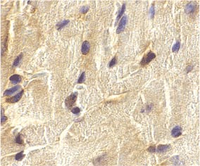 ab21288 at 2µg/ml staining ECSIT in mouse heart by IHC