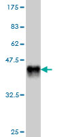 Western blot against tagged recombinant protein immunogen using ab56803 EDAR antibody at 1ug/ml.