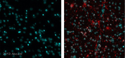 Immunohistochemical analysis of rat brain tissue, staining Corticotropin Releasing Factor with ab8901. Tissue was fixed with paraformaldehyde, permeabilized with 0.01% Triton X-100 and blocked with 10% serum for 1 hour at 25&degC; antigen retrieval was by heat mediation in a citrate buffer (pH 6). Samples were incubated with primary antibody (1/100 in diluent) for 24 hours at 4°C. An AlexaFluor®594-conjugated goat anti-rabbit polyclonal IgG (1/500) was used as the secondary antibody. The figure on the left is a secondary only control.See Abreview