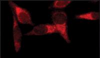 HeLa cells fixed and permeabilized with methanol followed by acetone. Fixed cells were stained with 1 µg/mL ab50313."