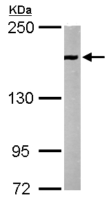 Anti-EEA1 antibody - C-terminal (ab137403) at 1/1000 dilution + Mouse brain whole cell lysate at 50 µg