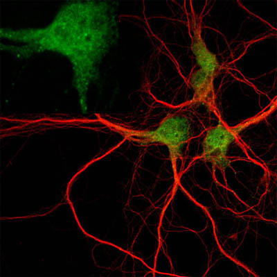 Confocal microscopy of fixed primary cultures of rat hippocampal neurons (embryonic day 18) showing immunocytochemical labelling of rabbit polyclonal to EEA1 (ab2900, 1/200; Alexa Fluor 488 1/200; green) and monoclonal mouse anti-b-tubulin-II (1/400; Alexa Fluor 568 1/200; red). Magnification 63x ; insert 180x.