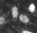 Immunolocalisation of EEA1 in HeLa cells using ab2900.