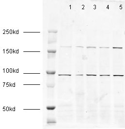 All lanes : Anti-EEA1 antibody - Early Endosome Marker (ab2900) at 1/1000 dilutionLane 1 : HeLa nuclearLane 2 : HeLa whole cell lysateLane 3 : A431 cell lysateLane 4 : Jurkat cell lysateLane 5 : HEK293 cell lysateLysates/proteins at 20 µg per lane.SecondaryAlexa Fluor anti rabbit at 1/50000 dilutionPerformed under reducing conditions.