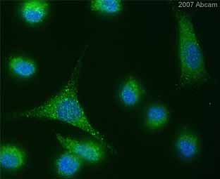 ab2900 staining mouse L-cells by ICC/IF. Cells were formaldehyde fixed, permeabilized in Triton X-100 and incubated with ab2900 diluted 1/1000 for 1 hour at 37°C. A Cy2® conjugated goat anti-rabbit antibody was used as the secondary.See Abreview
