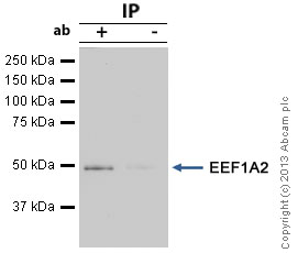 EEF1A2 was immunoprecipitated using 0.5mg MCF7 whole cell extract, 5µg of Rabbit polyclonal to EEF1A2 and 50µl of protein G magnetic beads (+). No antibody was added to the control (-).The antibody was incubated under agitation with Protein G beads for 10min, MCF7 whole cell extract lysate diluted in RIPA buffer was added to each sample and incubated for a further 10min under agitation.Proteins were eluted by addition of 40µl SDS loading buffer and incubated for 10min at 70°C; 10µl of each sample was separated on a SDS PAGE gel, transferred to a nitrocellulose membrane, blocked with 5% BSA and probed with ab60283.Secondary: Mouse monoclonal [SB62a] Secondary Antibody to Rabbit IgG light chain (HRP) (ab99697).Band: 50kDa; EEF1A2