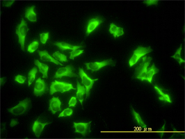 EEF1G antibody (ab54961) used in immunofluorescence at 10ug/ml on HeLa cells.