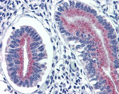 ab111075 at 6 µg/ml staining Cortisol Binding Globulin in formalin-fixed, paraffin-embedded Human Uterus by Immunohistochemistry. Detection utilised biotinylated secondary antibody, alkaline phosphatase-streptavidin and chromogen.