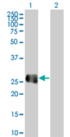 All lanes : Anti-EFCBP2 antibody (ab66972) at 1/500 dilutionLane 1 : EFCBP2 transfected 293T cell lysateLane 2 : Non-transfected 293T cell lysateLysates/proteins at 25 µg per lane.SecondaryGoat Anti-Mouse IgG (H&L)-HRP Conjugate at 1/2500 dilution