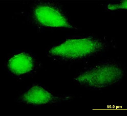 Immunofluorescence of purified ab66972 on HeLa cells. Antibody concentration of 10ug/ml.