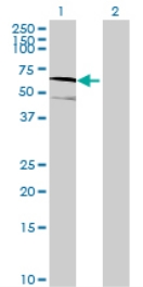 All lanes : Anti-EFHA2 antibody (ab71991) at 1/500 dilutionLane 1 : EFHA2 transfected 293T cell lysateLane 2 : Non transfected 293T cell lysateLysates/proteins at 25 µg per lane.SecondaryGoat anti-mouse IgG (H&L)-HRP conjugate at 1/2500 dilution
