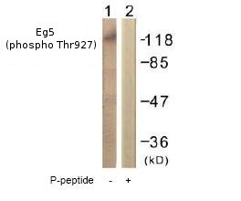 All lanes : Anti-Eg5 (phospho T927) antibody (ab61104) at 1/500 dilutionLane 1 : Extracts from COLO205 cells.Lane 2 : Extracts from COLO205 cells with the immunising peptide