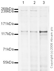 All lanes : Anti-Eg5 antibody [mAbcam 51976] (ab51976) at 5 µg/mlLane 1 : HEK293 (Human embryonic kidney cell line) Whole Cell Lysate Lane 2 : A431 (Human epithelial carcinoma cell line) Whole Cell LysateLane 3 : Jurkat (Human T cell lymphoblast-like cell line) Whole Cell Lysate Lysates/proteins at 10 µg per lane.SecondaryRabbit polyclonal to Mouse IgG - H&L (HRP) at 1/2000 dilutionPerformed under reducing conditions.