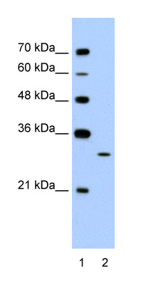 Anti-EGFL8 antibody (ab58650) at 1.25 µg/ml + Jurkat cell lysate at 10 µgSecondaryHRP conjugated anti-Rabbit IgG at 1/50000 dilution