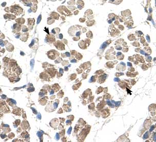 Immunohistochemistry (Formalin/PFA-fixed paraffin-embedded sections) analysis of human muscle tissue labelling EGFL8 with ab58650 at 4-8µg/ml. Arrows indicate positively labelled skeletal muscle cells. Magnification: 400X.