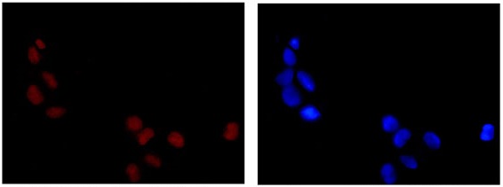 Immunofluorescence analysis of COUP TF1 in 4% paraformaldehyde fixed 293 cells using ab181137 at 1/100 (red). Alexa Fluor 555 conjugated Goat anti Rabbit IgG was used as a secondary antibody at 1/200 dilution, with Dapi staining (blue).
