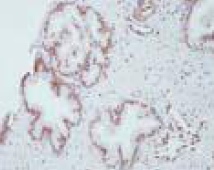 ab41858 staining COUP TF1 in human prostate gland (10-50 ug/mL) by Immunohistochemistry, formalin-fixed paraffin embedded sections.