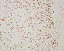 ab41858 staining COUP TF1 in rat cerebrum (10-50 ug/mL) by Immunohistochemistry, formalin-fixed paraffin embedded sections.
