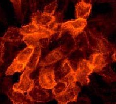 Immunofluorescent analysis of EGFR (phospho Y1086) expression in A431 cell culture, using 1/100 ab32086.