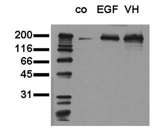 All lanes : Anti-EGFR (phospho Y1173) antibody [9H2] (ab24912) at 0.5 µg/mlLane 1 : Whole cell extracts of control (co) A549 tumor cellsLane 2 : Whole cell extracts of EGF stimulated (EGF) A549 tumor cellsLane 3 : Whole cell extracts of pervanadate treated (VH) A549 tumor cellsLysates/proteins at 20000 cells per lane.SecondaryA HRP-conjugated antibodydeveloped using the ECL technique